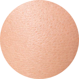Niacinamide